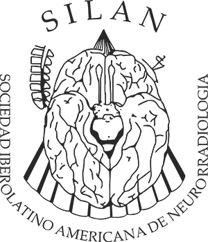 Silan