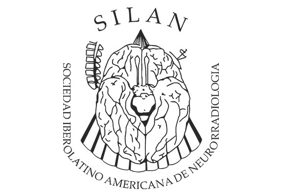SILAN